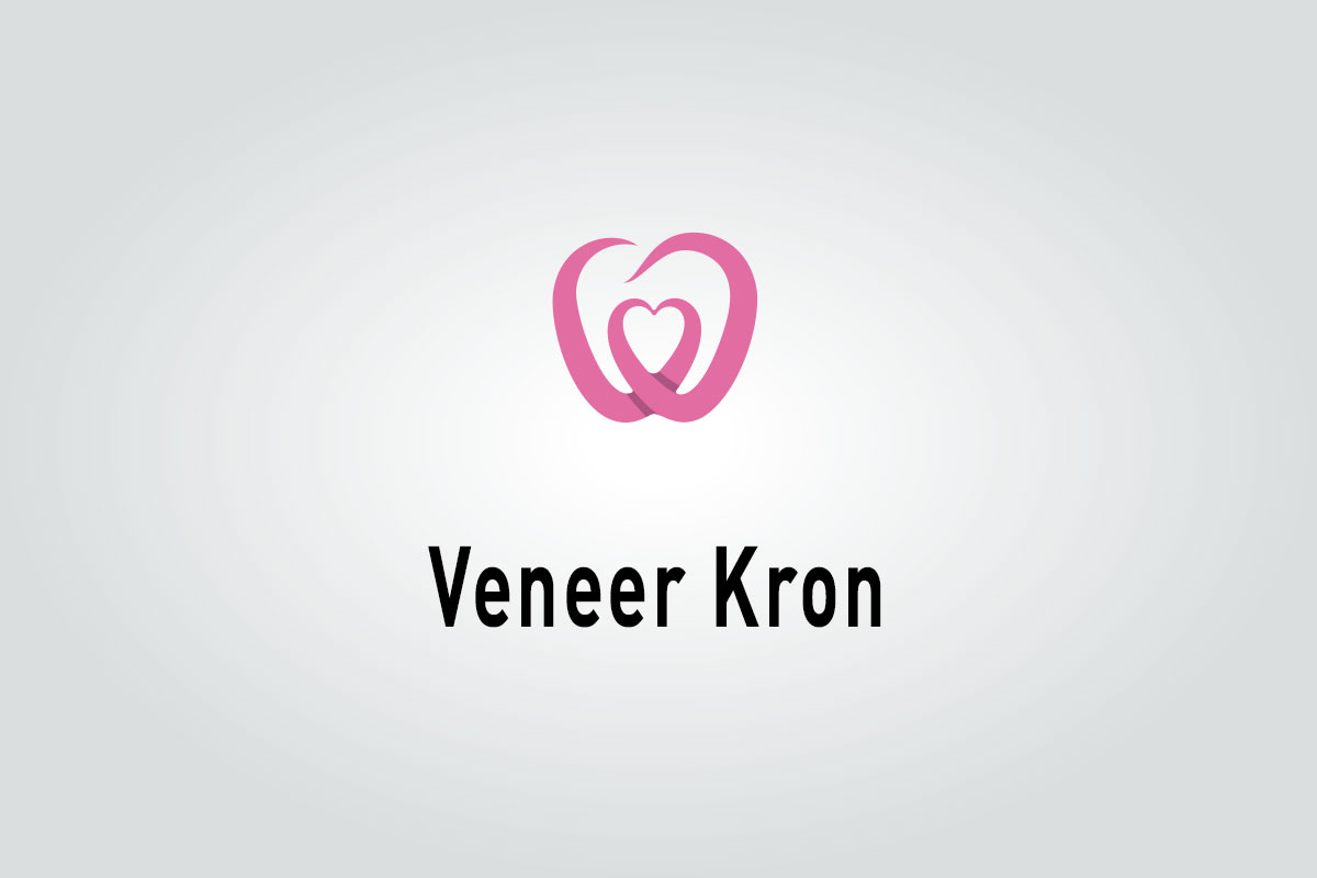 Veneer Kron